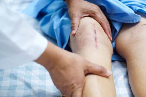 Cicatrice al ginocchio.