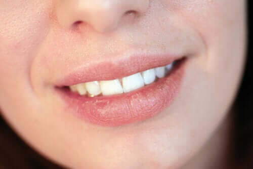 Labbra secche: le cause più comuni