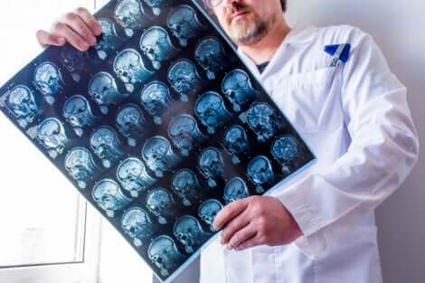 Dottore controlla tomografia computerizzata cerebrale.