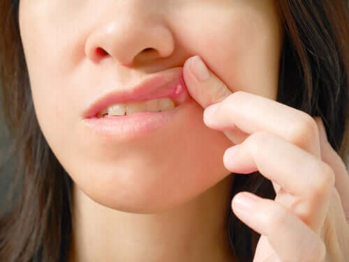 Ferite in bocca: cause e trattamenti