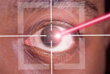Chirurgia refrattiva laser LASIK: pro e contro
