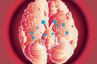 Nervi cranici: quali funzioni hanno?