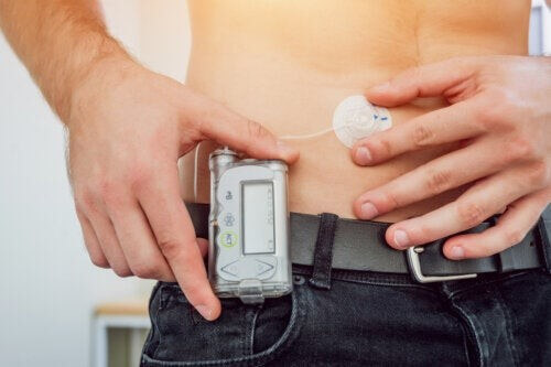 Pompa di insulina: che cos'é e quali vantaggi offre?