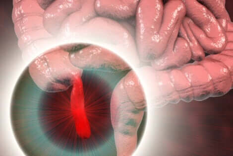 Ubicazione anatomica della appendice.