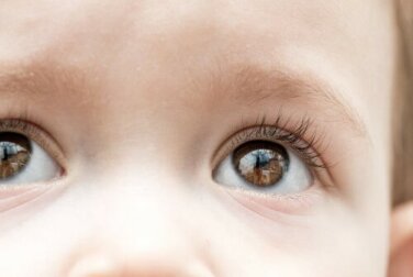 Il glaucoma infantile può portare alla cecità