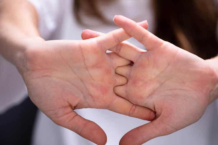 Mani in flessione per il morbo di Dupuytren.
