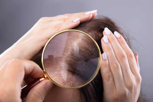 Osservare i capelli.