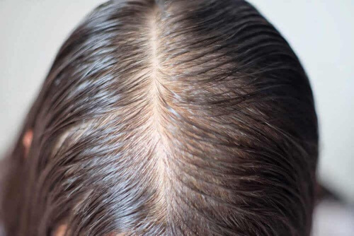Cuoio capelluto.