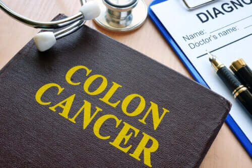 Esami per prevenire il tumore al colon.