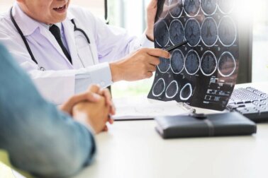 Infezioni della bocca e Alzheimer: cosa dice la scienza