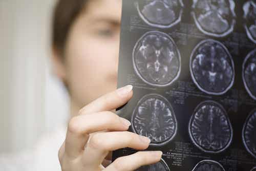 Medico che studia una radiografia.