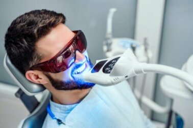 Lo sbiancamento dei denti quanto dura?