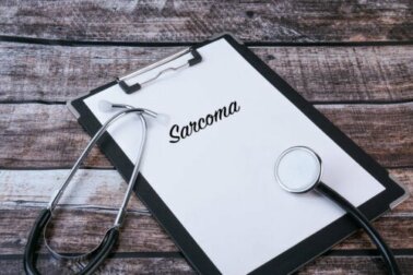 Sarcoma di Kaposi: causa, sintomi e trattamento