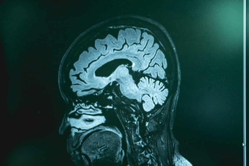 Radiografia del cervello.
