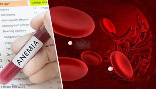 Analisi del sangue e anemia.