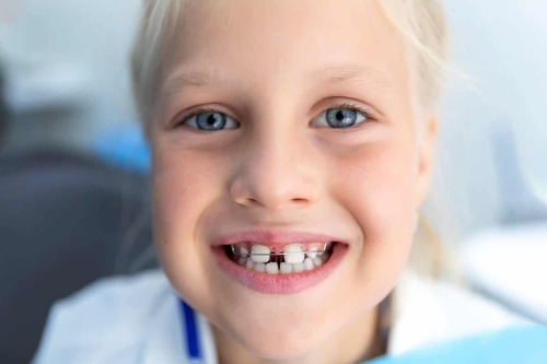 Bambina con diastema dentale.