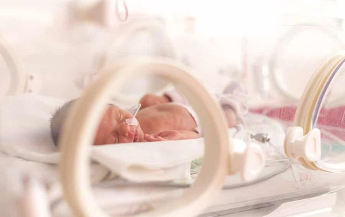 Bambino prematuro a causa della superfetazione.
