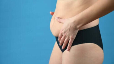 Diastasi dei retti addominali: cose fare (e cosa non fare)?