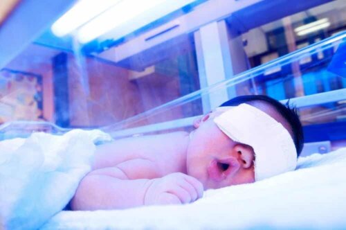 Fototerapia per il trattamento dell'ittero neonatale.