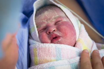 Vernice caseosa: che cos'è, a cosa serve e quando rimuoverla?