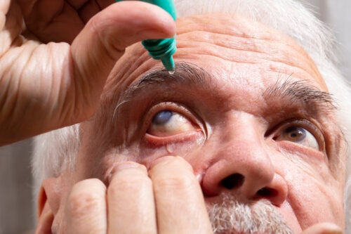Pilocarpina oftalmica: che cos'è e quando è consigliata?