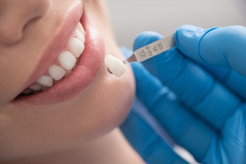 Corone dentali: quando usarle?
