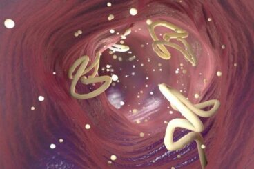 Trattare i parassiti intestinali con aglio o semi di zucca