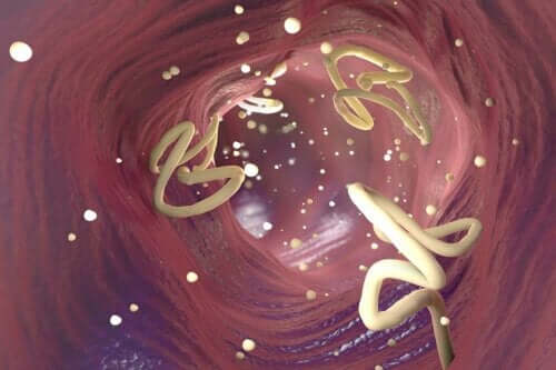 Trattare i parassiti intestinali con aglio o semi di zucca