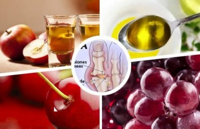 12 rimedi naturali per trattare i sintomi della gotta