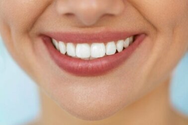 Come sbiancare i denti in modo naturale