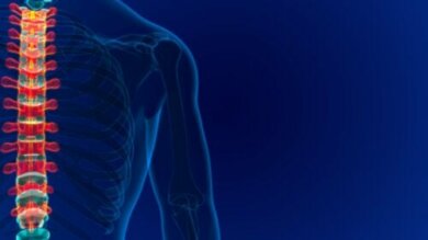 Angioma vertebrale: cause, sintomi e trattamento