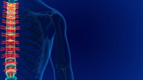 Angioma vertebrale: cause, sintomi e trattamento