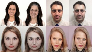 6 effetti negativi dello stress sulla nostra immagine