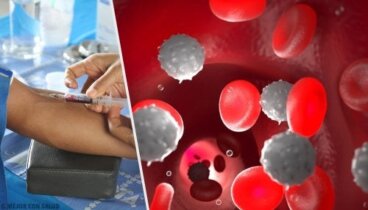 Presenza di leucociti nelle urine: cosa significa?