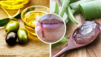 Labbra bruciate dal sole: 7 rimedi naturali