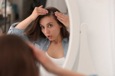 Quali tipi di alopecia colpiscono di più le donne?