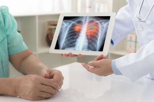 Macchia nei polmoni: cause principali e come curarla