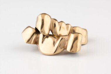 Grillz sui denti: possibili rischi