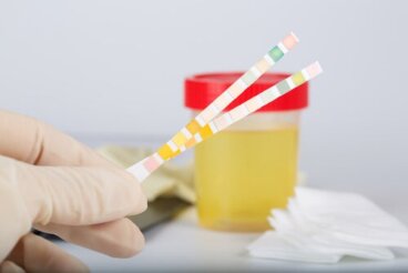 Il pH delle urine, che cos'è?