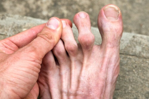 Dolore alle dita dei piedi: possibili cause