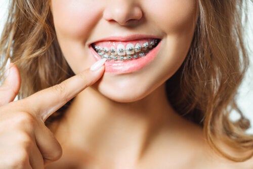 Estrazione dentale: è necessaria prima dell’ortodonzia?