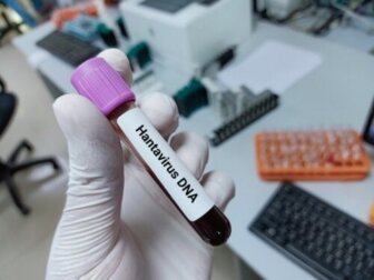 Infezioni da hantavirus: cosa bisogna sapere