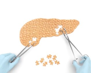 Cisti pancreatiche: cause, sintomi e trattamento