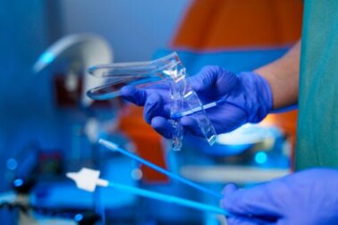 Criochirurgia del collo dell'utero: cos'è e quando si usa