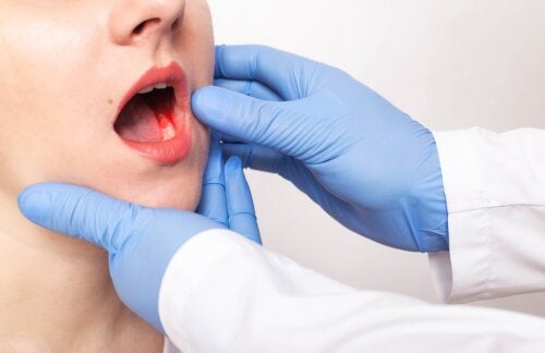 Sintomi e cause della parodontite