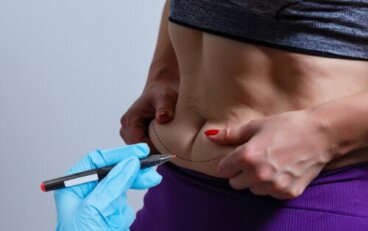 BodyTite, tecnologia per ridurre la flaccidità del corpo