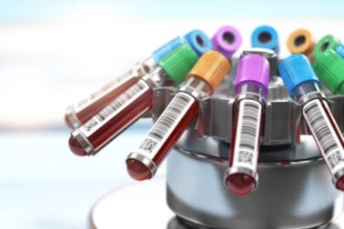 Nuovo test del sangue rileva diversi tipi di tumore prima che si sviluppino i sintomi