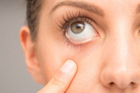 7 consigli per trattare il tic oculare nervoso
