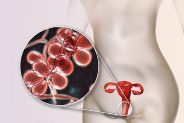 Perdite vaginali gialle con e senza odore: 5 cause e trattamento