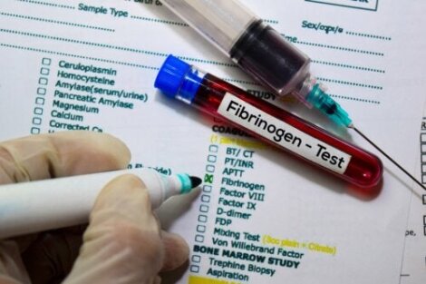 Test del fibrinogeno nel sangue: funzioni e risultati